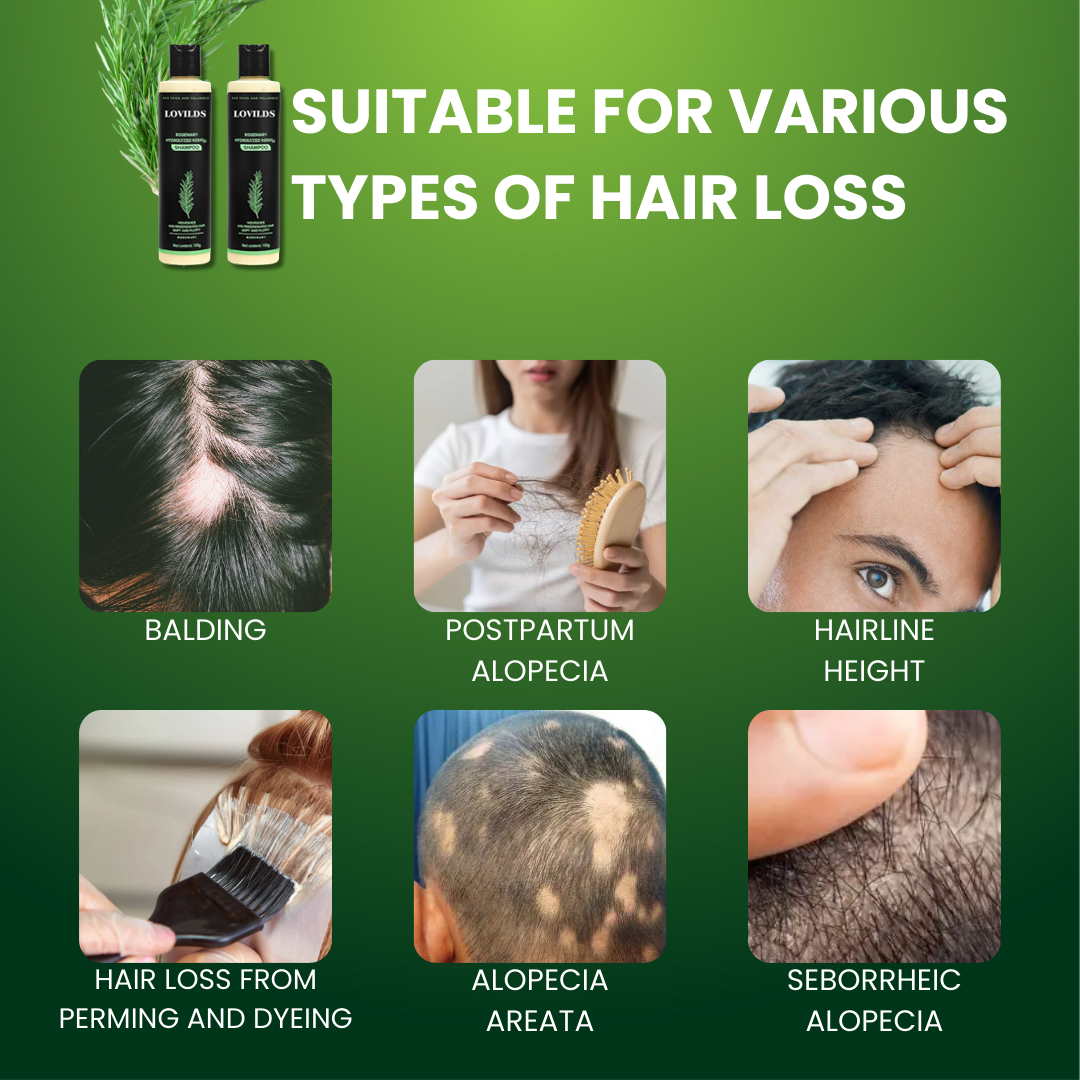 Rosemary Keratin Shampoo (80% OFF Today!)