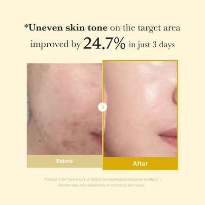 The Viral Turmeric Mask